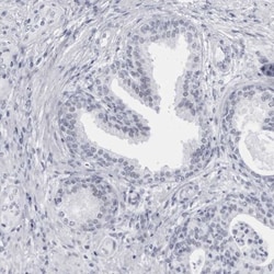 CCDC181 Antibody, Novus Biologicals:Antibodies:Primary Antibodies