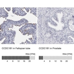 CCDC181 Antibody, Novus Biologicals:Antibodies:Primary Antibodies