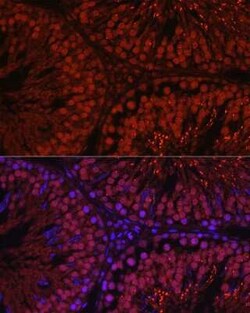 C1orf146 Rabbit anti-Mouse, Rat, Polyclonal, Novus Biologicals 20 &mu;g | Buy Online | Novus Biologicals | Fisher Scientific