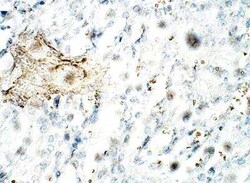 C1orf146 Antibody, Novus Biologicals 100 &mu;g; Unconjugated:Antibodies,
