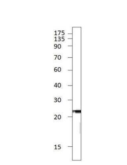 C1orf146 Antibody, Novus Biologicals 100 &mu;g; Unconjugated:Antibodies,