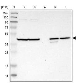 C1orf159/RIVIG Antibody, Novus Biologicals 0.1mL; Unlabeled:Antibodies,