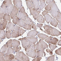 PERM1 Antibody, Novus Biologicals 0.1mL; Unlabeled:Antibodies, Polyclonal