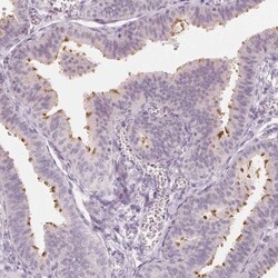 C1orf194 Antibody, Novus Biologicals 0.1mL; Unlabeled:Antibodies, Polyclonal