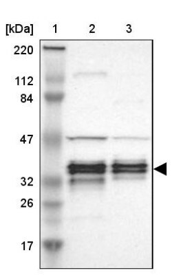 C1orf198 Antibody, Novus Biologicals:Antibodies:Primary Antibodies