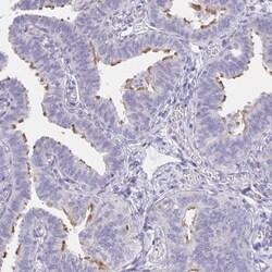 CFAP74 Antibody, Novus Biologicals 0.1mL; Unlabeled:Antibodies, Polyclonal