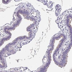 CFAP74 Antibody, Novus Biologicals 0.1mL; Unlabeled:Antibodies, Polyclonal