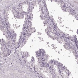 MENT Antibody, Novus Biologicals 0.1mL; Unlabeled:Antibodies, Polyclonal