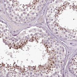 MENT Antibody, Novus Biologicals 0.1mL; Unlabeled:Antibodies, Polyclonal