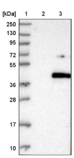 MENT Antibody, Novus Biologicals 0.1mL; Unlabeled:Antibodies, Polyclonal