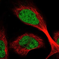 FAAP20 Antibody, Novus Biologicals:Antibodies:Primary Antibodies