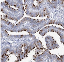 C1orf87 Antibody, Novus Biologicals 0.1mL; Unlabeled:Antibodies, Polyclonal