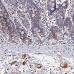 C1q Antibody, Novus Biologicals 25 &mu;L; Unlabeled:Antibodies, Polyclonal
