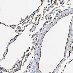 C1qR1/CD93 Antibody, Novus Biologicals 25 &mu;L; Unlabeled:Antibodies,