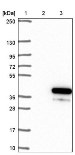 OSER1 Antibody, Novus Biologicals:Antibodies:Primary Antibodies