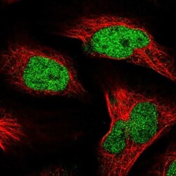 Nucleolar Protein 4 Like Antibody, Novus Biologicals:Antibodies:Primary