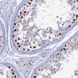 Nucleolar Protein 4 Like Antibody, Novus Biologicals 25 &mu;L | Buy Online | Novus Biologicals | Fisher Scientific