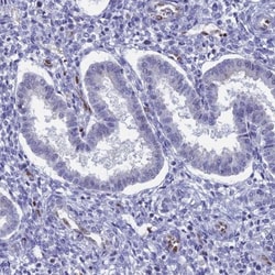 Nucleolar Protein 4 Like Antibody, Novus Biologicals:Antibodies:Primary