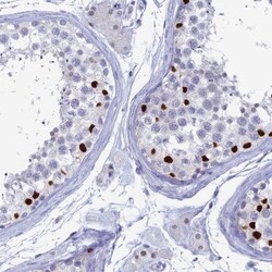 Nucleolar Protein 4 Like Antibody, Novus Biologicals:Antibodies:Primary