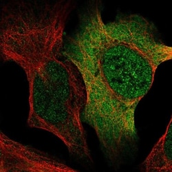 AP5S1 Antibody, Novus Biologicals 25 &mu;L, Unlabeled:Antibodies, Polyclonal