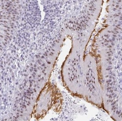 LLC1 Antibody, Novus Biologicals:Antibodies:Primary Antibodies