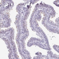 LLC1 Antibody, Novus Biologicals:Antibodies:Primary Antibodies