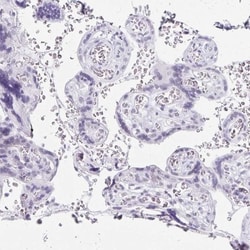 LLC1 Antibody, Novus Biologicals:Antibodies:Primary Antibodies