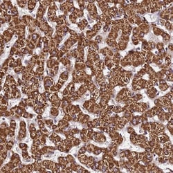 SLX4 Interacting Protein Antibody, Novus Biologicals:Antibodies:Primary