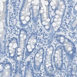 C21orf62 Antibody, Novus Biologicals 25 &mu;L; Unlabeled:Antibodies, Polyclonal