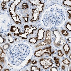 C21orf62 Antibody, Novus Biologicals 25 &mu;L; Unlabeled:Antibodies, Polyclonal