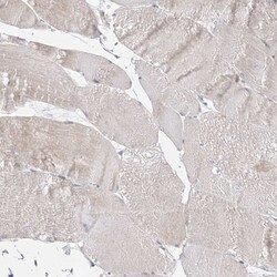 C2CD2 Antibody, Novus Biologicals 0.1mL; Unlabeled:Antibodies, Polyclonal