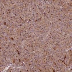 C2CD4B Antibody, Novus Biologicals 0.1mL; Unlabeled:Antibodies, Polyclonal