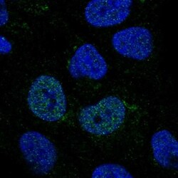 C2GNT3 Antibody, Novus Biologicals 0.1mL; Unlabeled:Antibodies, Polyclonal
