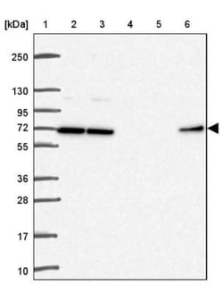 D-Glutamate Cyclase Antibody, Novus Biologicals 25 &mu;L, Unlabeled:Antibodies,