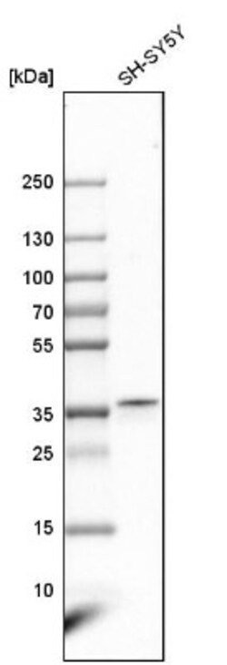 LDAH Antibody, Novus Biologicals:Antibodies:Primary Antibodies