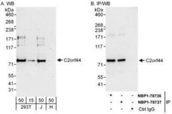 WDCP Antibody, Novus Biologicals 0.1mL; Unlabeled:Antibodies, Polyclonal