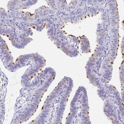 C2orf50 Antibody, Novus Biologicals 25 &mu;L, Unlabeled:Antibodies, Polyclonal