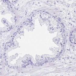 C2orf50 Antibody, Novus Biologicals 25 &mu;L, Unlabeled:Antibodies, Polyclonal