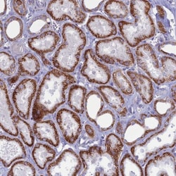 M1AP Antibody, Novus Biologicals:Antibodies:Primary Antibodies