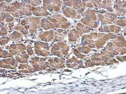 M1AP Antibody, Novus Biologicals 0.1 mL | Buy Online | Novus Biologicals | Fisher Scientific