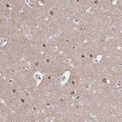 C2orf70 Antibody, Novus Biologicals 25 &mu;L, Unlabeled:Antibodies, Polyclonal