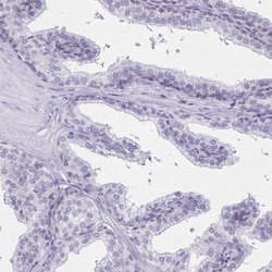 C2orf70 Antibody, Novus Biologicals 25 &mu;L, Unlabeled:Antibodies, Polyclonal