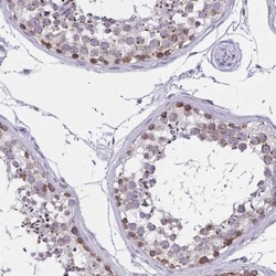 C2orf70 Antibody, Novus Biologicals 25 &mu;L, Unlabeled:Antibodies, Polyclonal