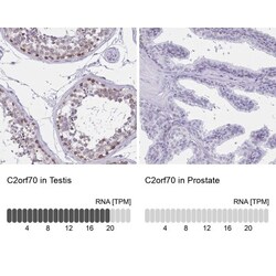 C2orf70 Antibody, Novus Biologicals 25 &mu;L, Unlabeled:Antibodies, Polyclonal