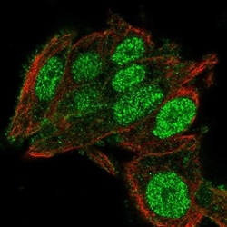 C2orf72 Antibody, Novus Biologicals:Antibodies:Primary Antibodies