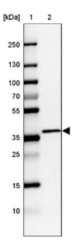 C2orf72 Antibody, Novus Biologicals:Antibodies:Primary Antibodies