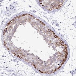 C3orf22 Antibody, Novus Biologicals:Antibodies:Primary Antibodies