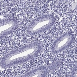 C3orf22 Antibody, Novus Biologicals:Antibodies:Primary Antibodies