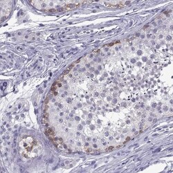 C3orf22 Antibody, Novus Biologicals:Antibodies:Primary Antibodies