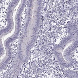TEX55 Antibody, Novus Biologicals 0.1mL; Unlabeled:Antibodies, Polyclonal